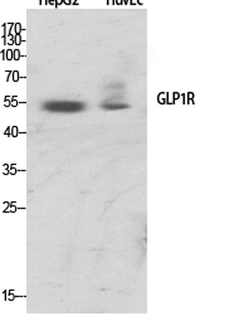 Western Blot analysis of various cells using GLP-1R Polyclonal Antibody