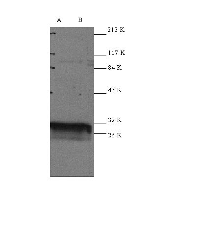 Western Blot analysis of 14-3-3 expression in HeL a (A) and Jurkat (B) whole cell lysates