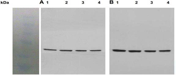 A) Western blot analysis of Akt activation using APB1729 Phospho Ser473 AKT in striatal neurons stimulated withDHPG (mGluR5 agonist) for 0 (lane 1), 2 (lane 2), 5 (lane 3) or 10 (lane4)min. B) Western blot analysis of total Akt (detected with anti- Akt1antibody, AB-82322 in striatal neurons stimulated with DHPG (a mGluR5 agonist) for 0 (lane 1), 2 (lane 2), 5 (lane 3) or10 (lane 4) min. Wells were equally loaded with 100 μg of whole celllysate proteins