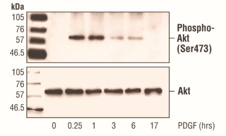 Western blot analysis of extracts from NIH/3T3 cells, untreated or PDGFtreated (50 ng/ml) for the indicated times, using PhosphoAkt (Ser473) Antibody (upper) or Akt Antibody (lower).