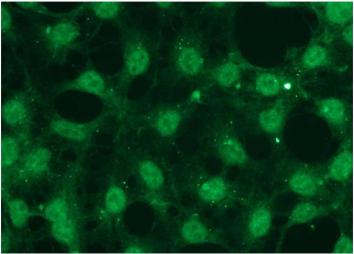 Representative picture of Akt1 expression in HEK293 cells, visualized with rabbit anti-Akt1 monospecific antibody. Primary antibody dilution - 1:100.