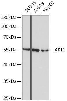 Western blot analysis of extracts of various cell lines, using
AKT1 antibody at 1:300 dilution.
Secondary antibody: HRP Goat Anti-Mouse IgG (H+L) at
1:10000 dilution.
Lysates/proteins: 25ug per lane.
Blocking buffer: 3% nonfat dry milk in TBST.
Detection: ECL West Pico Plus.
Exposure time: 90s.