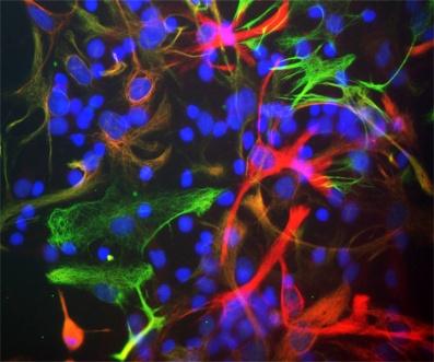 Mixed cultures of neonatal rat neurons and glia stained with Rat-401 (red), chicken antibody to vimentin (green) and DNA (DAPI stain, blue). Astrocytes and neuronal stem cells stain strongly and specifically in a clearly filamentous fashion with the MAB-11004 antibody. The filamentous staining pattern is as expected as both Nestin and vimentin are components of 10nm filaments. Note that some cells contain Nestin, but do not stain strongly for vimentin and so appear red. Others contain vimentin and not Nestin and so appear green- these are likely to be fibroblastic or endothelial cells. Some cells express both proteins and so appear yellowish. The presence of nestin indicates that the cells are developing astrocytes, neuroblasts or undifferentiated neural stem cells