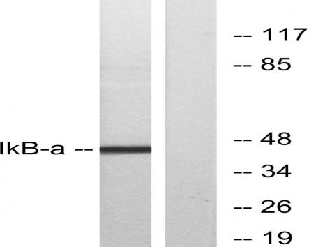 Western blot analysis of lysates from MCF7 cells, treated with TNF-α, using IkappaB-alpha Antibody.
The lane on the right is blocked with the synthesized peptide.