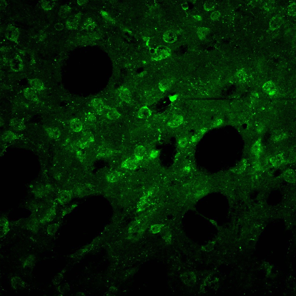 Working Dilutions Primary Antibody: 1:300
Tests performed by Fusco F.R., Giampà C. Neuroanatomy Lab. Fondazione S. Lucia, Roma