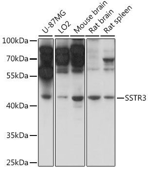 Western blot analysis of various lysates using SSTR3 Rabbit pAb at 1:1000 dilution.Secondary antibody: HRP Goat Anti-Rabbit IgG (H+L) at 1:10000 dilution. Lysates/proteins:25μg per lane.Blocking buffer: 3% nonfat dry milk in TBST.Detection: ECL West Pico Plus. Exposure time: 1s.