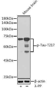Western blot analysis of extracts of Mouse brain, using Phospho-Tau-T217 antibody  at1:1000 dilution.Mouse brain were treated by λ-PP mixed solution (1ul) at 30℃ for 30 minutes. Secondary antibody: HRP Goat Anti-Rabbit IgG (H+L) at 1:10000 dilution.Lysates/proteins: 25ug per lane.Blocking buffer: 3% nonfat dry milk in TBST. Detection: ECL West Pico Plus.  Exposure time: 90s.