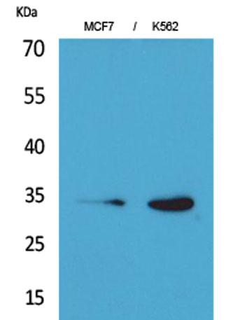 Western Blot analysis of MCF7, K562 cells using Cdk4 Polyclonal Antibody. Secondary antibody was diluted at 1:20000