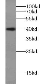 human brain tissue were subjected to SDS PAGE followed by western blot with DCX antibody at dilution of 1:600