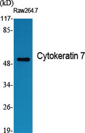 Western Blot analysis of various cells using Cytokeratin 7 Polyclonal Antibody diluted at 1:1000