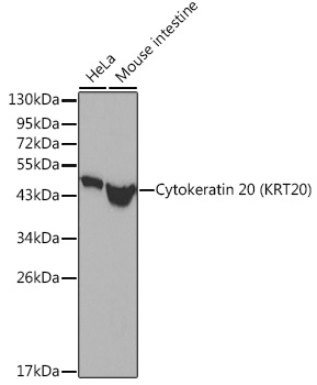 Western blot analysis of extracts of various cell lines, using Cytokeratin 20 (Cytokeratin 20 (KRT20))
antibody.
Secondary antibody: HRP Goat Anti-Rabbit IgG (H+L) at 1:10000 dilution.
Lysates/proteins: 25μg per lane.
Blocking buffer: 3% nonfat dry milk in TBST.