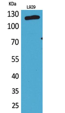Western Blot analysis of L929 cells using CD107a Polyclonal Antibody.
Secondary antibody was diluted at 1:20000s.