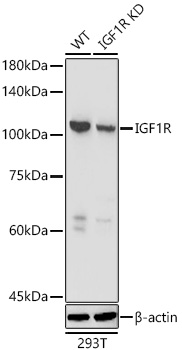 Western blot analysis of lysates from wild type (WT) and IGF1R knockdown (KD) 293T cells using 
[KDValidated] IGF1R Rabbit pAb  at 1:3000 dilution. 
Secondary antibody:HRP Goat Anti-Rabbit IgG (H+L) at 1:10000 dilution.
Lysates/proteins: 25 μg per lane. 
Blocking buffer: 3% nonfat dry milk in TBST. 
Detection: ECL West Pico Plus.     
Exposure time: 10s.
