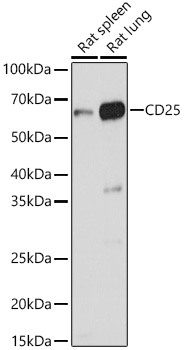 Western blot analysis of extracts of various cell lines, using CD25 antibody at 1:1000 dilution.
Secondary antibody: HRP Goat Anti-Rabbit IgG (H+L) at 1:10000 dilution.
Lysates/proteins: 25ug per lane.
Blocking buffer: 3% nonfat dry milk in TBST.
Detection: ECL West Pico Plus.
Exposure time: 3s.