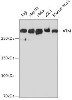 Western blot analysis of extracts of various cell lines, using ATM antibody at 1:1000 dilution.
Secondary antibody: HRP Goat Anti-Rabbit IgG (H+L) (AS014) at 1:10000 dilution.
Lysates/proteins: 25ug per lane.
Blocking buffer: 3% nonfat dry milk in TBST.
Detection: ECL West Pico Plus.
Exposure time: 90s.