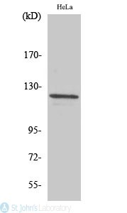 Western Blot (WB) analysis of specific cells using Vinculin polyclonal antibody
