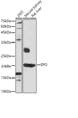 Western blot analysis of extracts of various cell lines, using EPO antibody at 1:1000 dilution.
Secondary antibody: HRP Goat Anti-Rabbit IgG (H+L) at 1:10000 dilution.
Lysates/proteins: 25ug per lane.
Blocking buffer: 3% nonfat dry milk in TBST.
Detection: ECL West Pico Plus.
Exposure time: 60s.