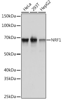 Western blot analysis of extracts of various cell lines, using NRF1 Rabbit mAb at 1:1000 dilution.
Secondary antibody: HRP Goat Anti-Rabbit IgG (H+L) at 1:10000 dilution.
Lysates/proteins: 25ug per lane.
Blocking buffer: 3% nonfat dry milk in TBST.
Detection: ECL Basic Kit.
Exposure time: 1s.