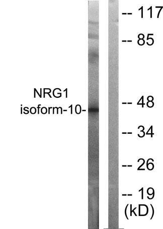 Western blot analysis of lysates from SKOV3 cells, using NRG1 isoform-10 Antibody. The lane on the right is blocked with the synthesized peptide.