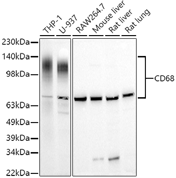 Western blot analysis of various lysates using CD68 Rabbit pAb at 1:1000 dilution.
Secondary antibody: HRP Goat Anti-Rabbit IgG (H+L) at 1:10000 dilution.
Lysates/proteins: 25μg per lane.
Blocking buffer: 3% nonfat dry milk in TBST.
Detection: ECL West Pico Plus.
Exposure time: 10s.