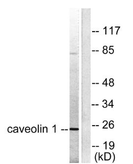 Western blot analysis of lysates from HUVEC cells, using Caveolin-1 Antibody. The lane on the right is blocked
with the synthesized peptide.