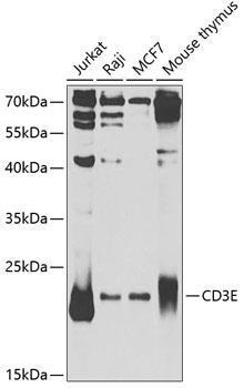 Western blot analysis of extracts of
various cell lines, using CD3E
Antibody at 1:1000 dilution.
Secondary antibody: HRP Goat Anti-
Rabbit IgG (H+L) at 1:10000
dilution.
Lysates/proteins: 25ug per lane.
Blocking buffer: 3% nonfat dry milk in
TBST.
Detection: ECL West Pico Plus
Exposure time: 5s