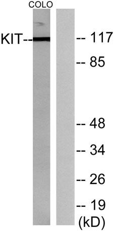 Western blot analysis of lysates from COLO205 cells, using CD117/c-kit Antibody. The lane on the right is blocked with the synthesized peptide