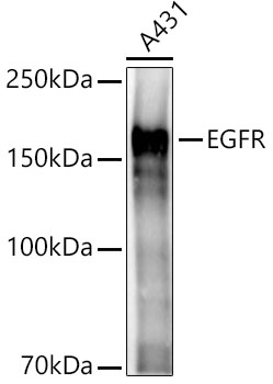 Western blot analysis of lysates from A431 cells, using EGFR Rabbit pAb at 1:2000 dilution.
Secondary antibody: HRP Goat Anti-Rabbit IgG (H+L) at 1:10000 dilution.
Lysates/proteins: 25ug per lane.
Blocking buffer: 3% nonfat dry milk in TBST.
Detection: ECL West Pico Plus.
Exposure time: 3s.
