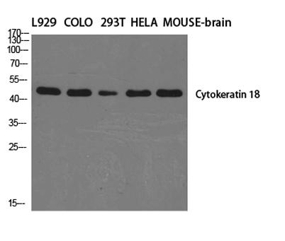 Western Blot analysis of various cells using Cytokeratin 18 Polyclonal Antibody diluted at 1:2000.