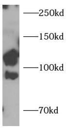 mouse brain tissue were subjected to SDS PAGE followed by western blot with (LGR5 antibody) at dilution of 1:1000