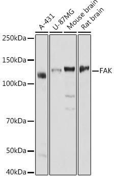 Western blot analysis of extracts of various cell lines, using FAK antibody at 1:1000 dilution.
Secondary antibody: HRP Goat Anti-Rabbit IgG (H+L) at 1:10000 dilution.
Lysates/proteins: 25ug per lane.
Blocking buffer: 3% nonfat dry milk in TBST.
Detection: ECL West Pico Plus
Exposure time: 1s.