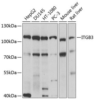 Western blot analysis of extracts of various cell lines, using ITGB3 antibody at 1:1000 dilution.
Secondary antibody: HRP Goat Anti-Rabbit IgG (H+L) at 1:10000 dilution.
Lysates/proteins: 25ug per lane.
Blocking buffer: 3% nonfat dry milk in TBST.
Detection: ECL West Pico Plus.
Exposure time: 10s.