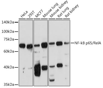 Western blot analysis of extracts of
various cell lines, using NF-kB p65
antibody  at 1:1000 dilution.
Secondary antibody: HRP Goat Anti-Rabbit IgG (H+L) at 1:10000 dilution.
Lysates/proteins: 25ug per lane.
Blocking buffer: 3% nonfat dry milk in TBST.
Detection: ECL West Pico Plus 
Exposure time: 90s.