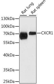 Western blot analysis of extracts of various cell lines, using CXCR1
antibody at 1:1000 dilution.
Secondary antibody: HRP Goat Anti- Rabbit IgG (H+L)at 1:10000 dilution.
Lysates/proteins: 25ug per lane.
Blocking buffer: 3% nonfat dry milk in
TBST.
Detection: ECL West Pico Plus.
Exposure time: 15s.