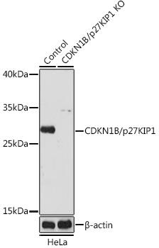 Western blot analysis of extracts from normal (control) and CDKN1B/p27KIP1 knockout (KO) HeLa cells, using CDKN1B/p27KIP1 antibody at 1:1000 dilution.
Secondary antibody: HRP Goat Anti-Rabbit IgG (H+L) at 1:10000 dilution.
Lysates/proteins: 25ug per lane.
Blocking buffer: 3% nonfat dry milk in TBST.
Detection: ECL West Pico Plus.
Exposure time: 3min.