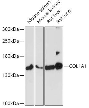 Western blot analysis of extracts of various cell lines, using COL1A1 antibody at 1:1000 dilution. Secondary antibody: HRP Goat Anti-Rabbit IgG (H+L) at 1:10000 dilution.
Lysates/proteins: 25ug per lane.
Blocking buffer: 3% nonfat dry milk in TBST.
Detection: ECL Basic Kit
Exposure time: 3min.