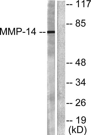 Western blot analysis of lysates from NIH/3T3 cells, using MMP-14 Antibody. The lane on the right is blocked with the synthesized peptide.