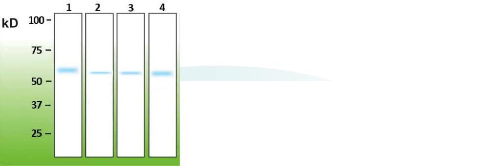 Anti – Akt (AB82322)
Western blot analysis of Akt1 protein in mouse crude protein brain extract: lane 2 – 20 µg; lane 3 -100 µg; lane 4 - 200 µg of total protein loaded. Lane 1 represents the band corresponding to a 100ng of recombinant human Akt1