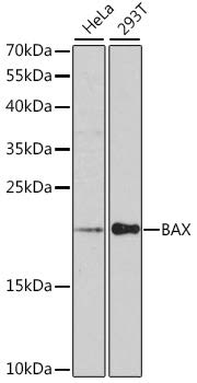 Western blot analysis of extracts of various cell lines, using BAX antibody at 1:1000 dilution.
Secondary antibody: HRP Goat Anti-Rabbit IgG (H+L) at 1:10000 dilution.
Lysates/proteins: 25ug per lane.
Blocking buffer: 3% nonfat dry milk in TBST.
Detection: ECL Enhanced Kit
Exposure time: 90s.