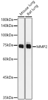 Western blot analysis of various lysates, using MMP2 Rabbit pAb at 1:1000 dilution.
Secondary antibody: HRP Goat Anti-Rabbit IgG (H+L)  at 1:10000 dilution.
Lysates/proteins: 25ug per lane.
Blocking buffer: 3% nonfat dry milk in TBST.
Detection: ECL West Pico Plus. 
Exposure time: 1s.