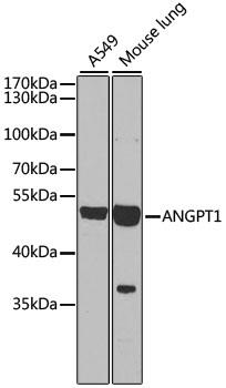 Western blot analysis of extracts of various cell lines, using ANGPT1 antibody  at 1:1000 dilution.
Secondary antibody: HRP Goat Anti-Rabbit IgG (H+L) at 1:10000 dilution.
Lysates/proteins: 25ug per lane.Blocking buffer: 3% nonfat dry milk inTBST.
Detection: ECL West Pico Plus Exposure time: 90s.