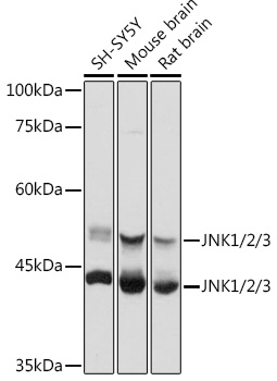Western blot analysis of extracts of various cell lines, using JNK1/2/3 antibody at 1:1000 dilution.
Secondary antibody: HRP Goat Anti-Rabbit IgG (H+L) at 1:10000 dilution.
Lysates/proteins: 25ug per lane.
Blocking buffer: 3% nonfat dry milk in TBST.
Detection: ECL West Pico Plus.
Exposure time: 5s.