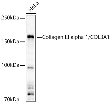 Western blot analysis of lysates from HeLa cells using Collagen III alpha 1/COL3A1 Rabbit pAb at 1:10000 dilution.
Secondary antibody:HRP Goat Anti-Rabbit IgG (H+L) at 1:10000 dilution.
Lysates/proteins: 25 μg per lane.
Blocking buffer: 3% nonfat dry milk in TBST.
Detection:ECL West Pico Plus.
Exposuretime:90s.