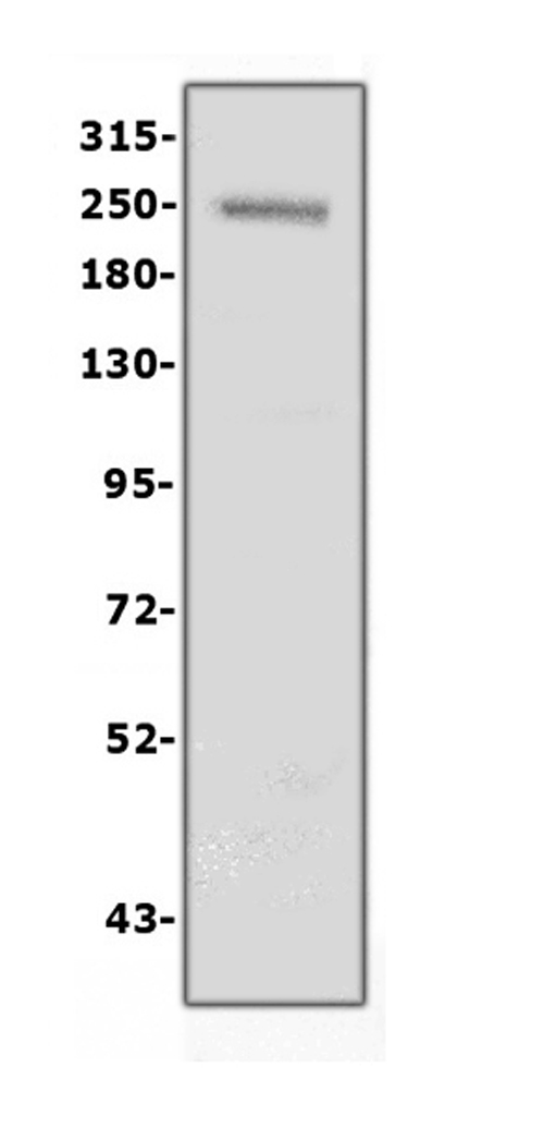 Western blot analysis of Collagen IV using anti- Collagen IV antibody.Electrophoresis was performed on a 5-20% SDS-PAGE gel at70V (Stacking gel) / 90V (Resolving gel) for 2-3 hours. The sample well of each lane was loaded with 50ug of sample under reducing conditions.
Lane 1: human placenta tissue lysates After Electrophoresis, proteins were transferred to a Nitrocellulose membrane at 150mA for 50-90 minutes. Blocked the membrane with 5% Non-fat Milk/ TBS for 1.5 hour at RT. The membrane was incubated with rabbit anti- Collagen IV antigen affinity purified polyclonal antibody at 0.5 ug/mL overnight at 4°C, then washed with TBS-0.1%Tween 3 times with 5 minutes each and probed with a goat anti-rabbit IgG-HRP secondary antibody at a dilution of 1:10000 for 1.5 hour at RT. The signal is developed using an(ECL) kit ) with Tanon 5200 system. A specific band was detected for Collagen IV at approximately 250KD. The expected band size for Collagen IV is at 161KD.