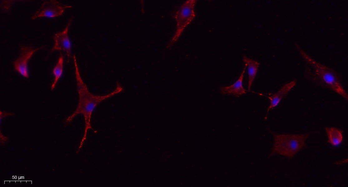Immunofluorescence analysis of A549. 1,primary Antibody(red) was diluted at 1:200(4°C overnight). 2, Goat Anti Rabbit IgG (H&amp;L) - Alexa Fluor 594 Secondary antibody was diluted at 1:1000(room temperature, 50min).3, Picture B: DAPI(blue) 10min.