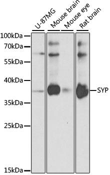 Western blot analysis of extracts of various cell lines, using Synaptophysin  antibody
at 1:1000 dilution.
Secondary antibody: HRP Goat Anti- Rabbit IgG (H+L) at 1:10000
dilution.
Lysates/proteins: 25ug per lane.
Blocking buffer: 3% nonfat dry milk in TBST.
Detection: ECL West Pico Plus 
Exposure time: 20s.