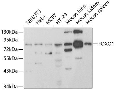 Western blot analysis of extracts of
various cell lines, using FOXO1
antibody at 1:950 dilution.
Secondary antibody: HRP Goat Anti-
Rabbit IgG (H+L) at 1:10000
dilution.
Lysates/proteins: 25ug per lane.
Blocking buffer: 3% nonfat dry milk in
TBST