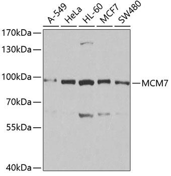 Western blot analysis of extracts of
various cell lines, using MCM7
antibody at 1:1000 dilution.
Secondary antibody: HRP Goat Anti-
Rabbit IgG (H+L) at 1:10000
dilution.
Lysates/proteins: 25ug per lane.
Blocking buffer: 3% nonfat dry milk in
TBST.
Detection: ECL West Pico Plus.
Exposure time: 10s.