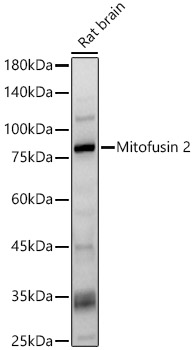 Western blot analysis of Rat brain, using Mitofusin 2 antibody at 1:400 dilution.
Secondary antibody: HRP Goat Anti-Rabbit IgG (H+L) at 1:10000 dilution.
Lysates/proteins: 25μg per lane.
Blocking buffer: 3% nonfat dry milk in TBST.
Detection: ECL Basic Kit.
Exposure time: 30s.