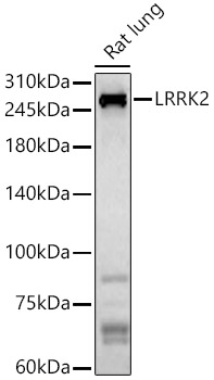 Western blot analysis of Rat lung, using LRRK2 antibody at 1:800 dilution.
Secondary Antibody: HRP Goat Anti-Rabbit IgG (H+L) at 1:10000 dilution.
Lysates/proteins: 25ug per lane.
Blocking buffer: 3% nonfat dry milk in TBST.
Detection: ECL Basic Kit.
Exposure time: 180s.